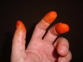 New Cheetos Finger Decision Rule for Abdominal Pain cheetos sign