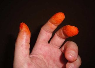 New Cheetos Finger Decision Rule for Abdominal Pain cheetos sign
