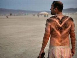 Millions of Men are Getting Bactrim for Summer