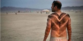 Millions of Men are Getting Bactrim for Summer