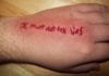 New Hospital Policy Aims to Punish Patients for Lying hospital lies
