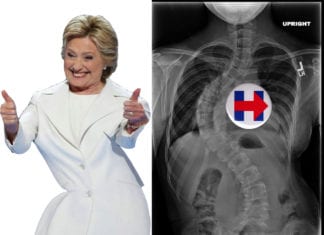 Crooked Hillary Actually Suffering From Severe Scoliosis