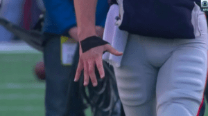 Tom Brady Super Bowl LII amputate hand