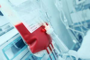 ridiculously restrictive transfusion