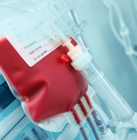 ridiculously restrictive transfusion