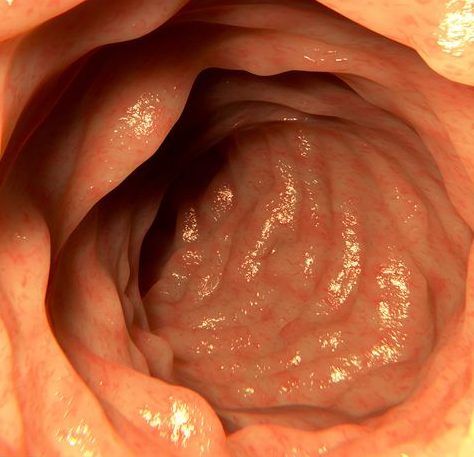 transurethral resection of the colon