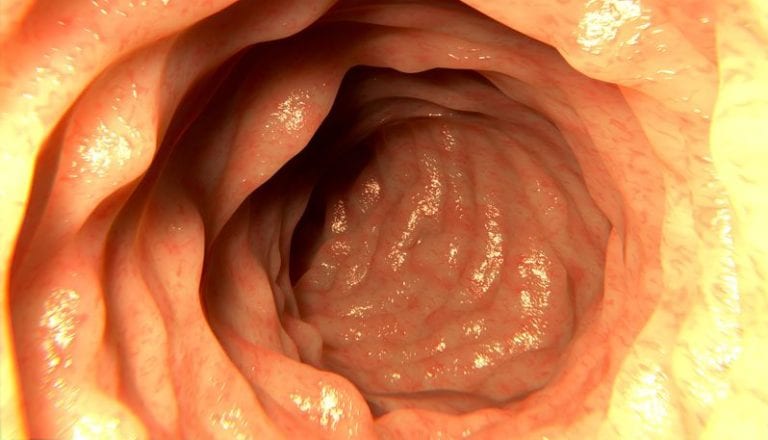 transurethral resection of the colon