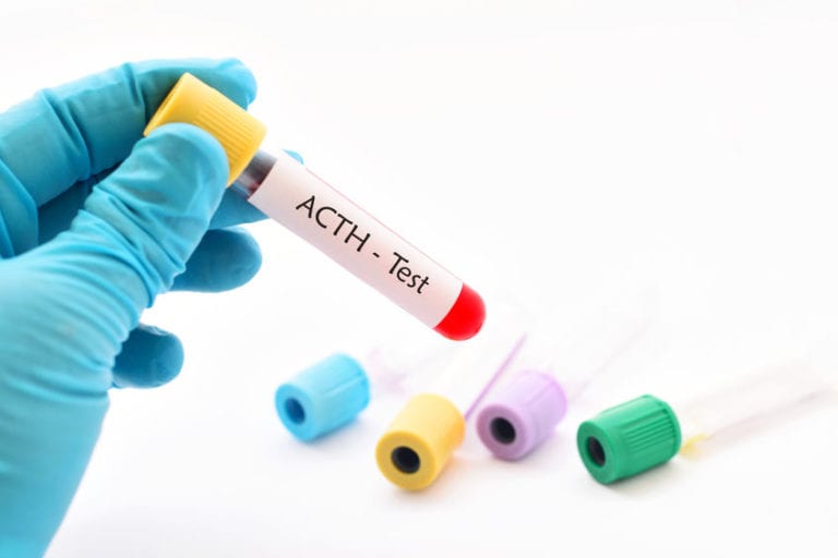 New ACTH Stim Test Measures Serum Cortisol Every Minute