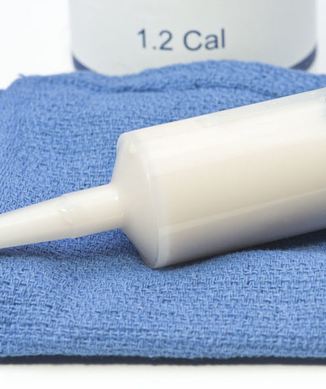 G-tube G-spot