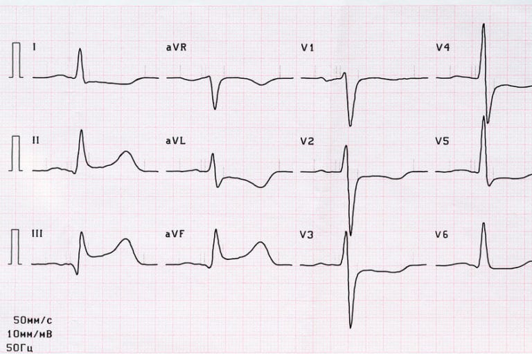 August Intern Pretty Sure This is Consistent with an ECG